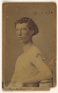 Private Ross Civil War victim; Attributed to William H. Bell, American, 1830 - 1910, 1865-1874; Albumen silver print