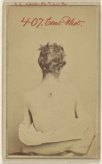 G.L. Mason, Pv. F. 211 Pa. Civil War victim; American; about 1865; Albumen silver print