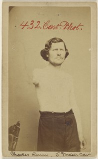 Charles Dunn 5th Mich. Cav. Civil War victim lacking an arm; American; 1864 - 1866; Albumen silver print