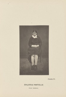 Épilepsie Partielle État Normal; Paul-Marie-Léon Regnard, French, 1850 - 1927, Paris, France; 1878; Photogravure; 10.2 × 6.1 cm