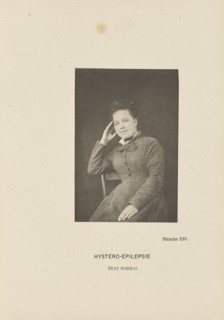 Hystéro-Épilepsie État Normal; Paul-Marie-Léon Regnard, French, 1850 - 1927, Paris, France; 1878; Photogravure; 9.5 × 6.4 cm