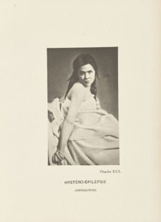 Hystero-Epilepsy Contraction; Paul-Marie-Léon Regnard, French, 1850 - 1927, Paris, France; 1878; Photogravure; 10.3 × 6.2 cm