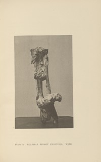 Multiple Spongy Exostosis; Charles B. Brigham, American, 1845 - 1903, Cambridge, Massachusetts, United States; 1876; Heliotype