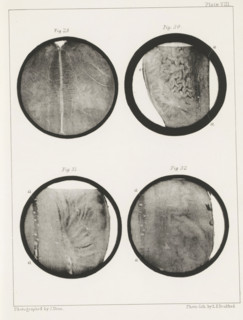 Four longitudinal and transverse sections of a human medulla oblongata, page, photomechanical