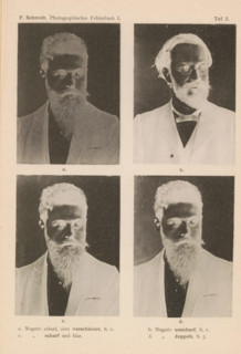 Three examples of an incorrectly exposed negative and an example of a correctly exposed negative,