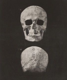 Two views of a human skull, front view and back view, 1. TÊTE HUMAINE FACE, 2. IDEM OCCIPUT VOIR PL