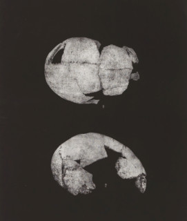 CRÂNE HUMAIN. 1. SINCIPUT, 2. PROFIL 1, 2 nature, Two views of a human skull, top view and en