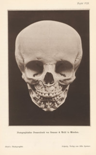Children's skull with alternating teeth, page, photomechanical print, number: 'Tafel VII.', cliché