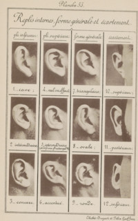 Replis interns, forme générale et écartement, Twelve images of ears, arranged by shape and width,