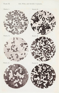 Six enlargements of blood cells, page, photomechanical print, number: 'Pl. II.', number: 'Photo. 1