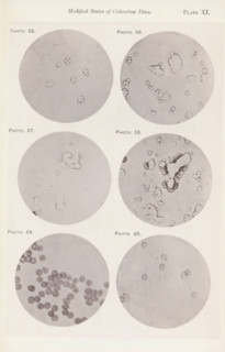 Six enlargements of colorless blood corpuscles, page, photomechanical print, number: 'Pl. XI.',