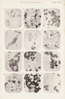Twelve enlargements of blood corpuscles, page, photomechanical print, number: 'Pl. XIII.', number: