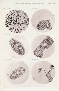 Six enlargements of blood cells, page, photomechanical print, number: 'Photo. 7., Photo. 12.',