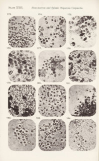Twelve enlargements of bone marrow, page, photomechanical print, number: 'Pl. XXII.', number: