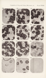 Eleven enlargements of blood cells and a micrometer enlargement, page, photomechanical print,