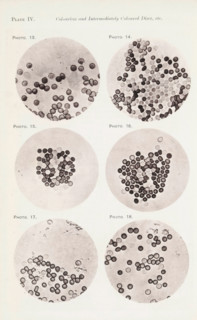 Six enlargements of blood cells, page, photomechanical print, number: 'Photo. 13., Photo. 18.',