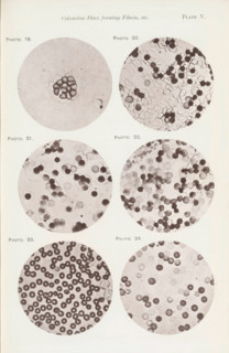 Six enlargements of blood cells, page, photomechanical print, number: 'Pl. V.', number: 'Photo. 19