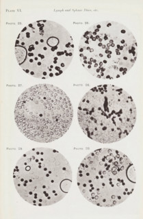 Six enlargements of blood cells and lymphocytes, page, photomechanical print, number: 'Pl. VI.',