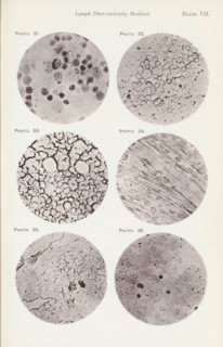 Six enlargements of lymphocytes, page, photomechanical print, number: 'Pl. VII.', number: 'Photo.