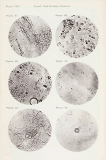 Six enlargements of lymphocytes, page, photomechanical print, number: 'Pl. VIII.', number: 'Photo.