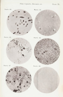 Five enlargements of blood and a micrometer, page, photomechanical print, number: 'Pl. IX.',