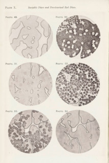 Six enlargements of blood after various procedures, page, photomechanical print, number: 'Pl. X.',
