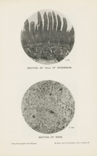 Section of villi of duodenum, Section of bone, page, photomechanical print, inscription: 'x 50. x