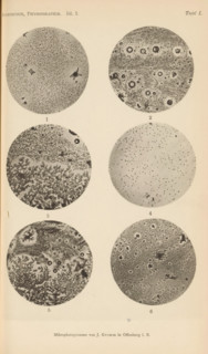 Six microscopic enlargements of minerals, page, photomechanical print, Image 1, 2 and 3 is sulphur,