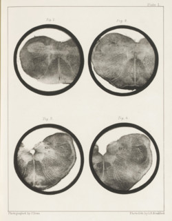 Four details of a medulla oblongata of a sheep, page, photomechanical print, number: 'Plate I. Fig.