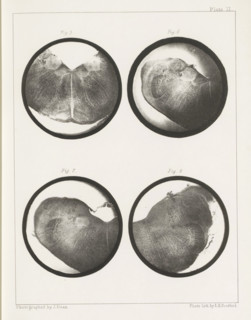 Four cross-sections of a medulla oblongata of a sheep, page, photomechanical print, number: 'Plate