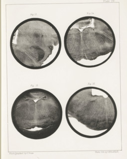 Four details of a sheep medulla oblongata, page, photomechanical print, number: 'Plate IV. Fig. 13.