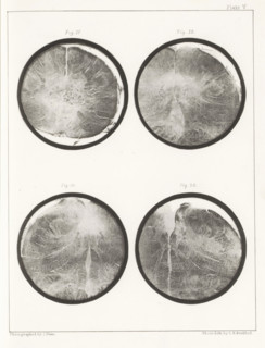 Four details of a human medulla oblongata, page, photomechanical print, number: 'Plate V. Fig. 17.