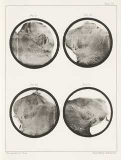 Four details of a human medulla oblongata, page, photomechanical print, number: 'Plate VI. Fig. 21.