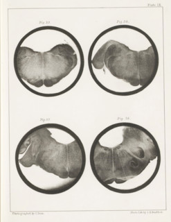 Four details of a human medulla oblongata, page, photomechanical print, number: 'Plate IX. Fig. 33.