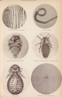 Overview of six microscopic enlargements, page, photomechanical print, Top two hairworms, middle