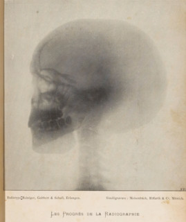 X-ray of a human skull, Les Progrès de la Radiography, page, photomechanical print, photographer: