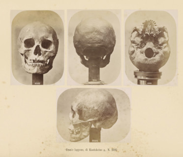 Four images of a Sami male skull, Cranio lappone, di Kautokeino ?, No. 2595, page, Top left a front