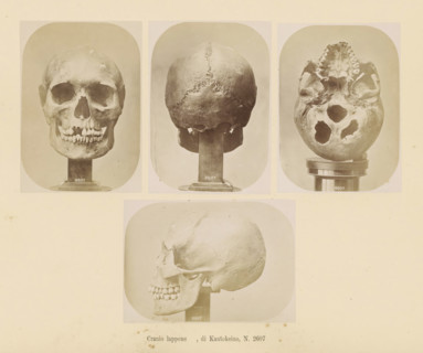 Four images of a Sami skull, Cranio lappone, di Kautokeino, No. 2607, page, Top left a front view,