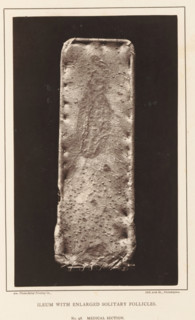 Ileum with Enlarged Solitary Follicles, page, photomechanical print, address: '1002 Arch St.,