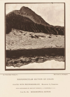 Enlargement of a membrane in a piece of large intestine, Perpendicular Section of Colon Coated with