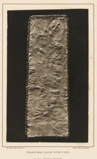 Transverse Colon with Cysts, page, photomechanical print, address: '1002 Arch St., Philadelphia.',