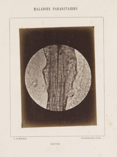 Favus, Microscope image of the disease favus, photograph, page, number: '12', inscription:
