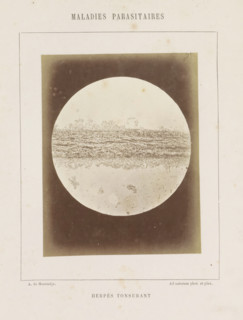 Microscopic image of ringworm on the head, Herpès tonsurant, photograph, page, number: '17',
