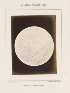Oidium albicans (Muguet), Microscope image of probably candida albicans, photograph, page,