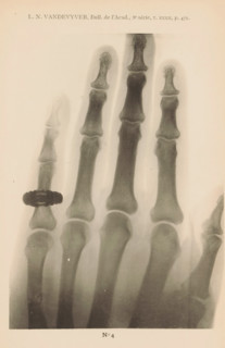 X-ray of a hand, page, photomechanical print, number: 'No 4', photographer: Guequier, Ghent, maker:
