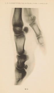 X-ray of a pig's leg, page, photomechanical print, number: 'No 6', photographer: Guequier, Ghent,