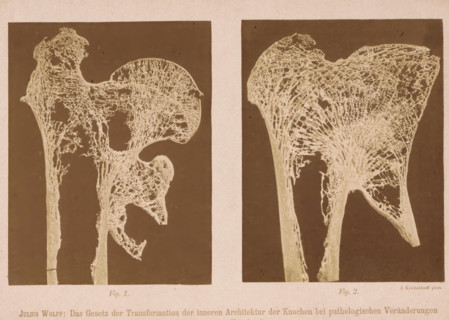 Twice a detail of the structure of the interior of a bone, Julius Wolff: The Gesetz der