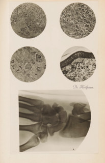 Four enlargements of x-rays, photograph, page, name: 'Drs. Hauchamps et Steinhaus', c. 1904 - in or