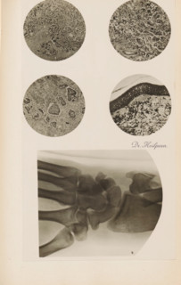 X-ray of a wrist, photograph, page, name: 'Dr. Heilporn', c. 1904 - in or before 1909,