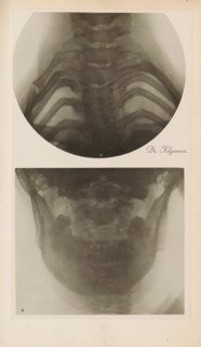 X-ray of an upper and lower jaw, photograph, page, name: 'Dr. Klynens.', c. 1904 - in or before